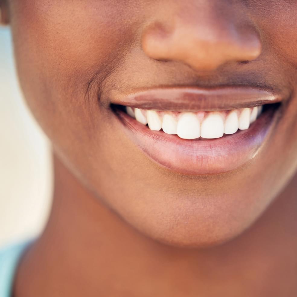 My Dental Hub close-up smile showcasing cosmetic dentistry treatment results in Skokie, IL
