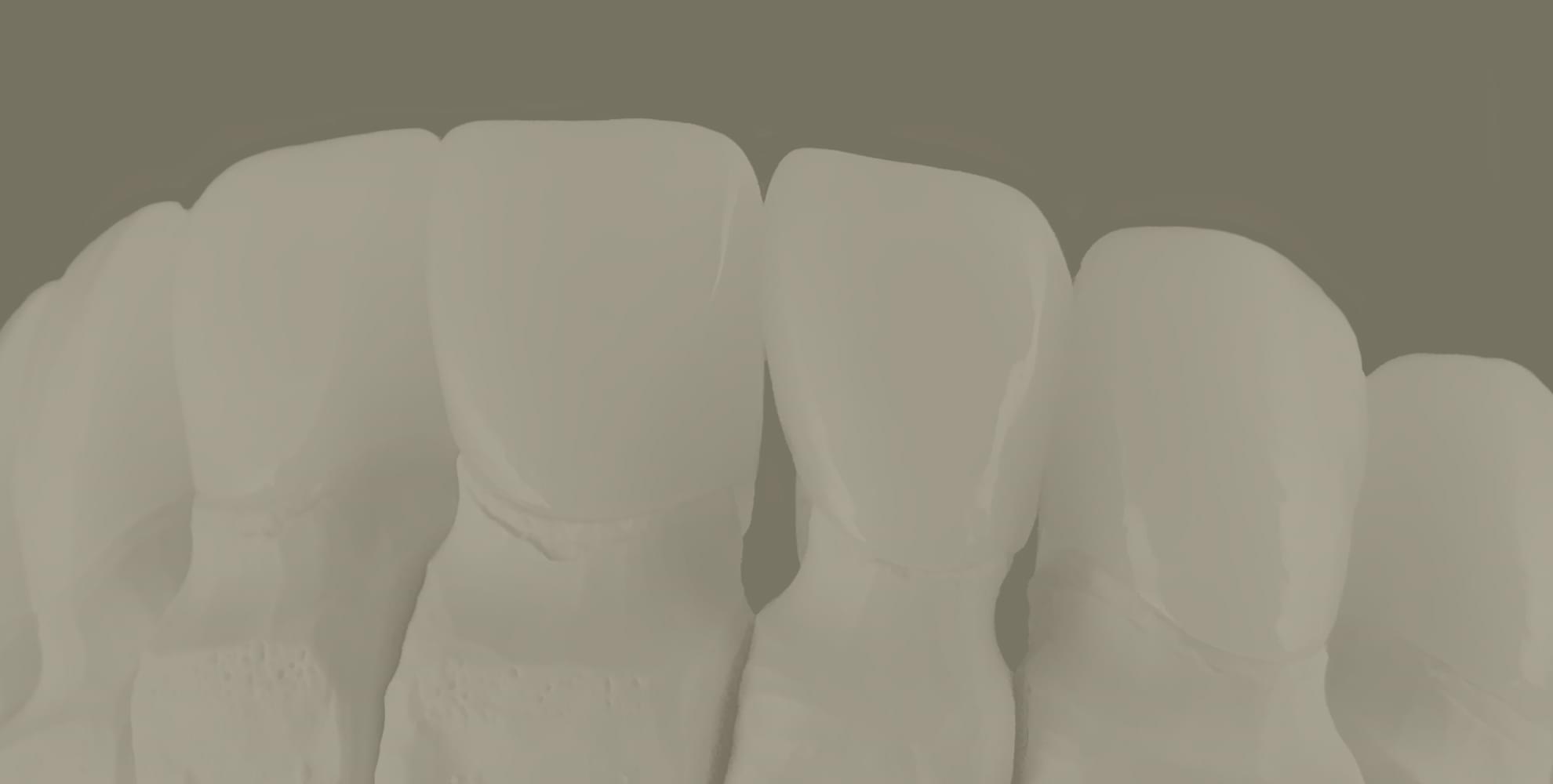 My Dental Hub hero banner image promoting dental bridge treatment in Skokie, IL