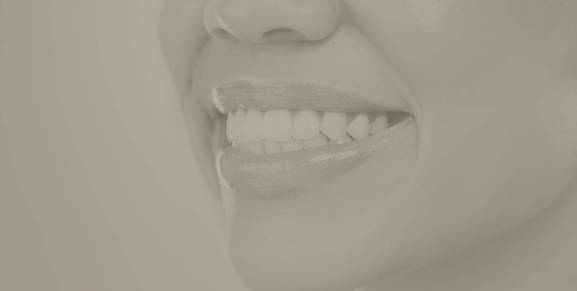 Dental Checkups
