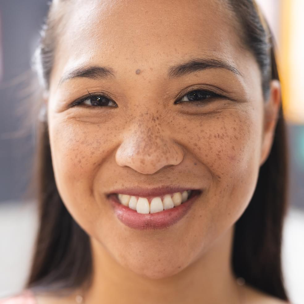 My Dental Hub patient smiling with newly placed porcelain dental crowns in Skokie, IL