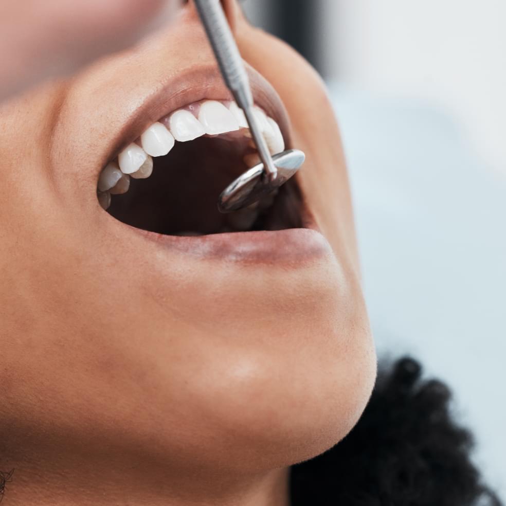Tooth Removal