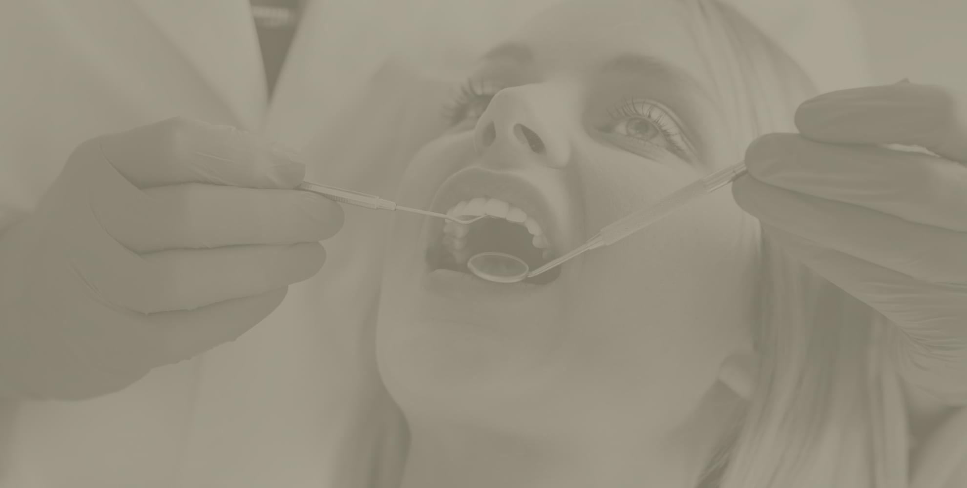 Dental Fillings