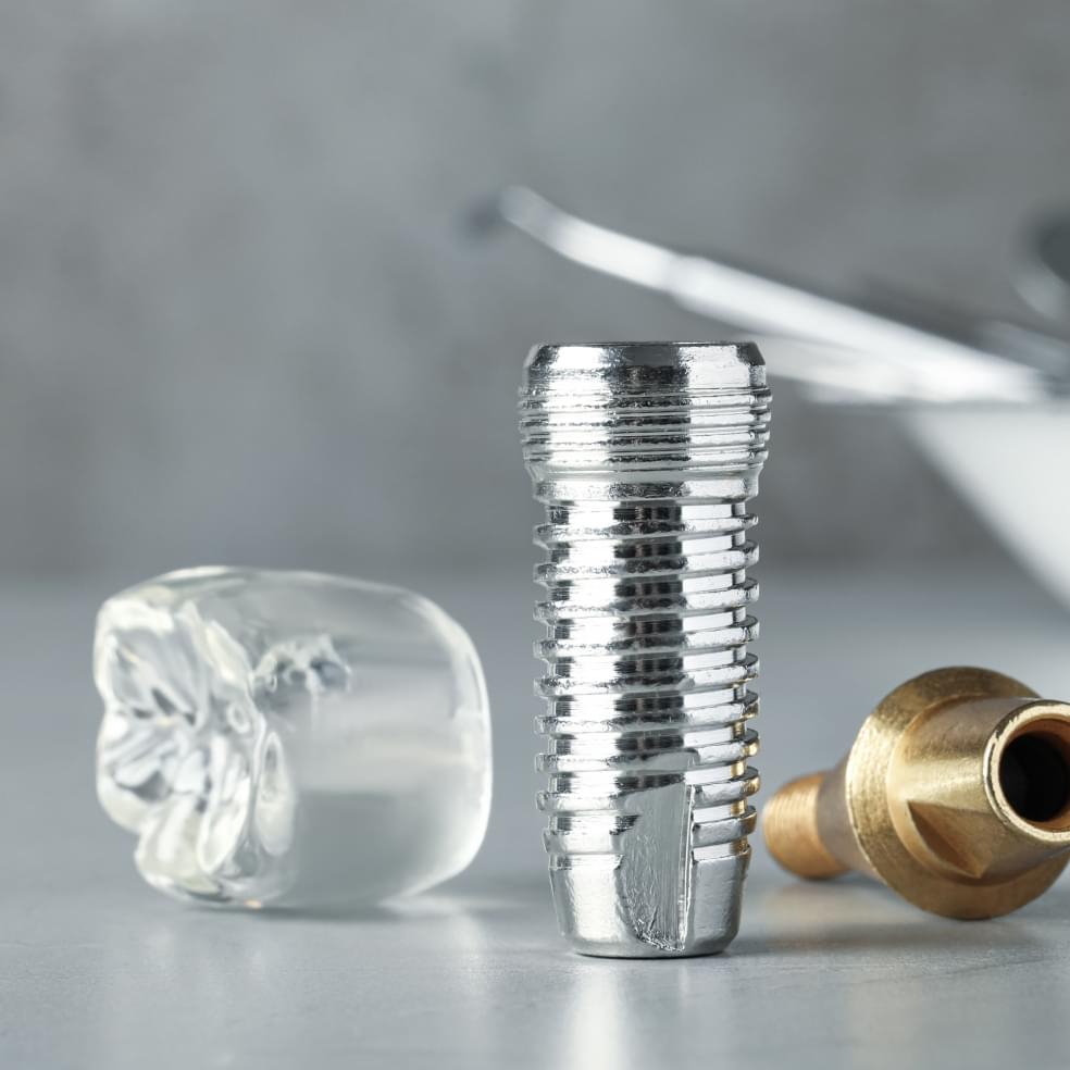 My Dental Hub dental model demonstrating a single tooth implant placement in Skokie, IL