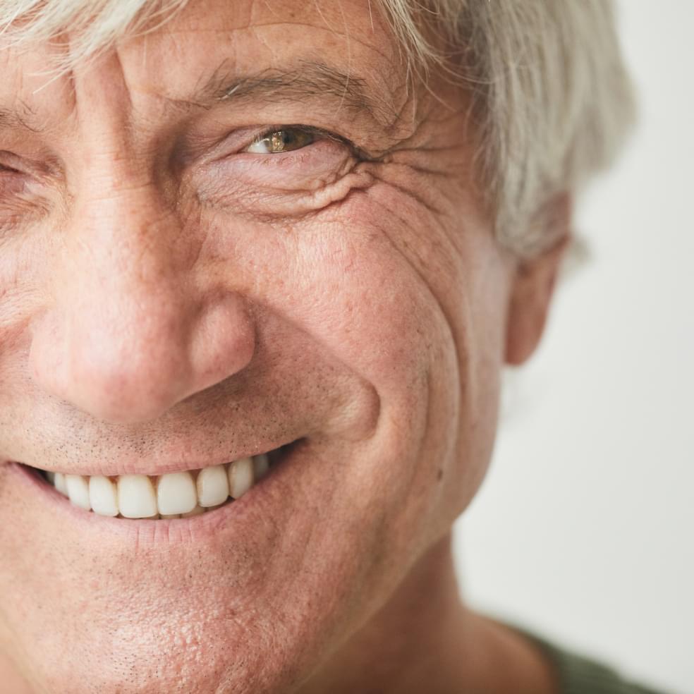Partial Dentures