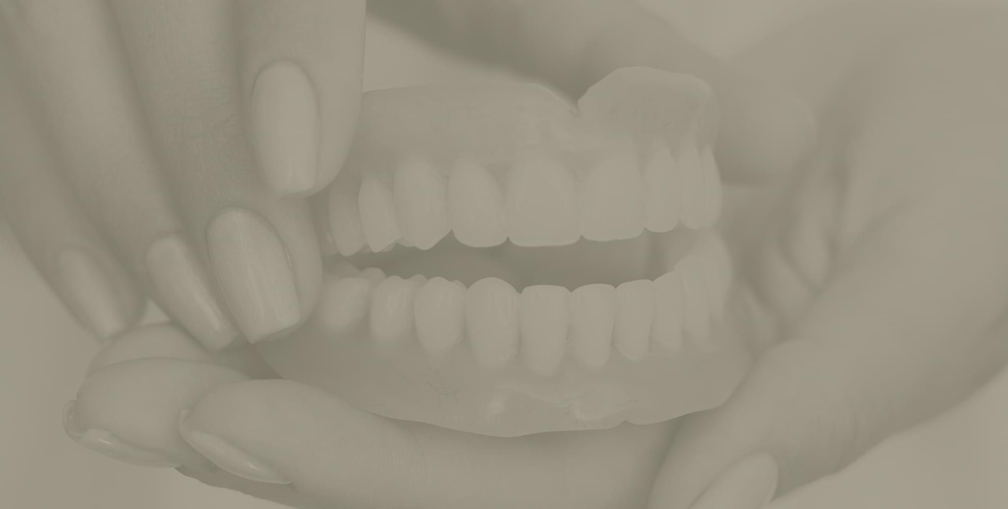 Complete Dentures