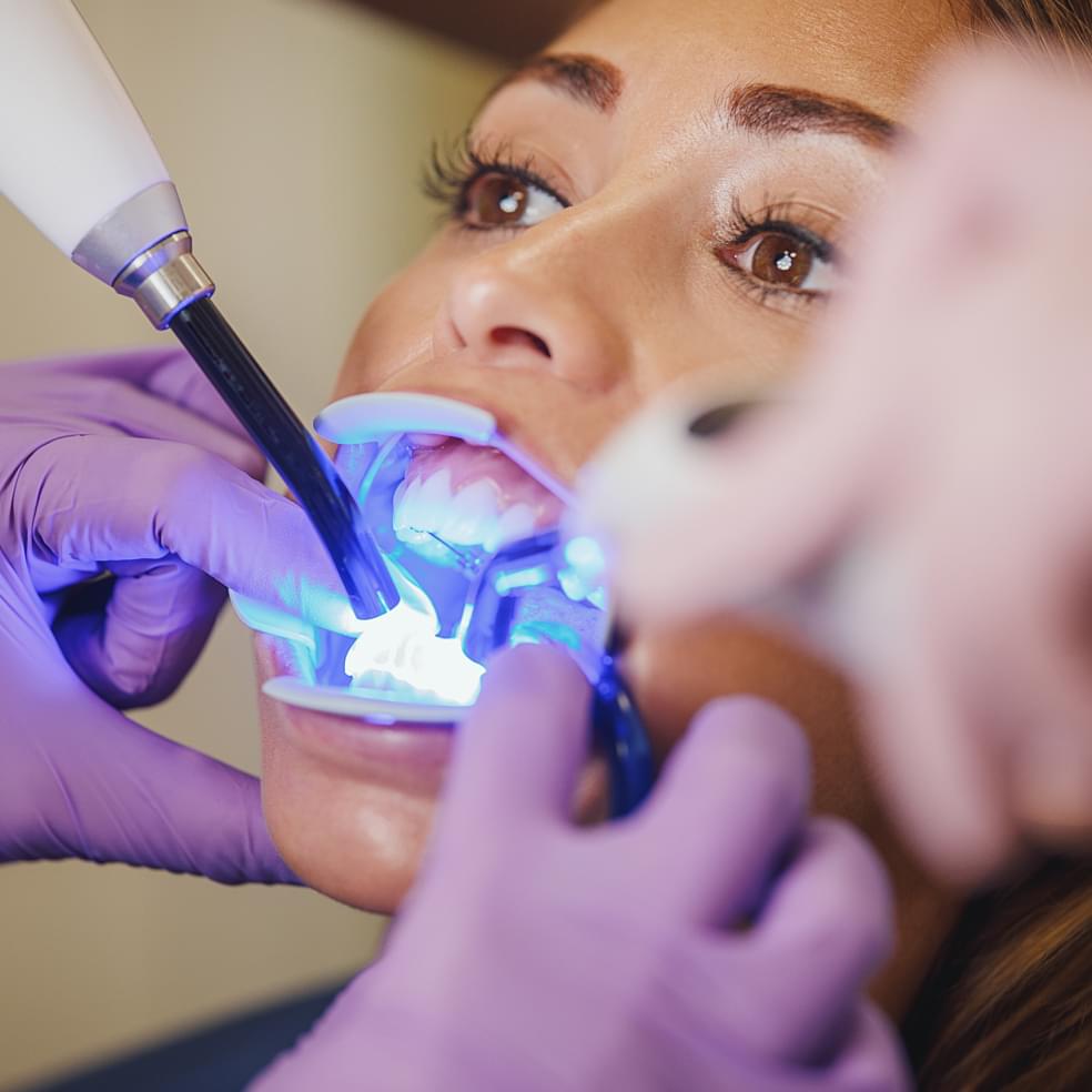 Tooth Filling