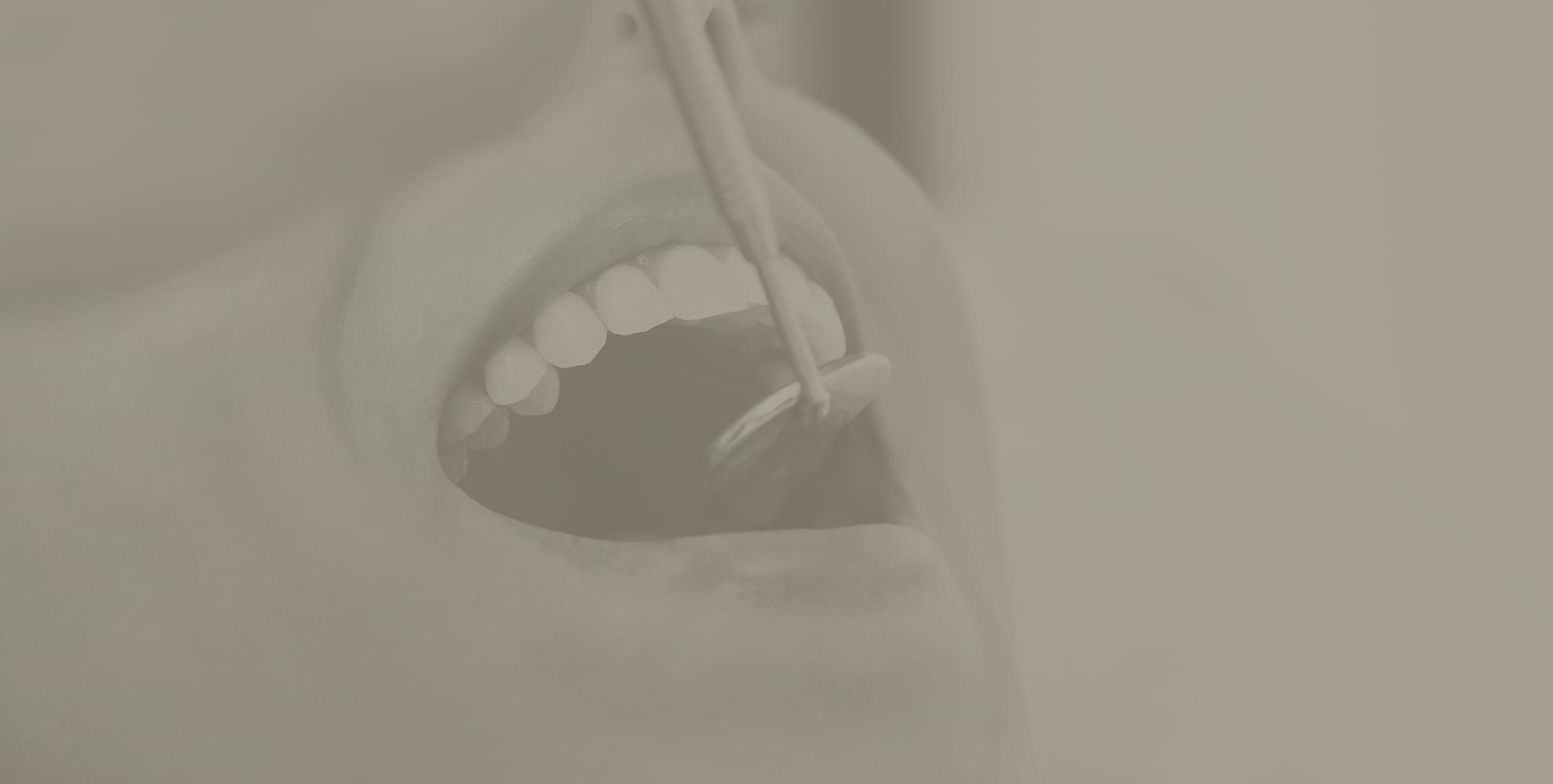 Tooth Extractions