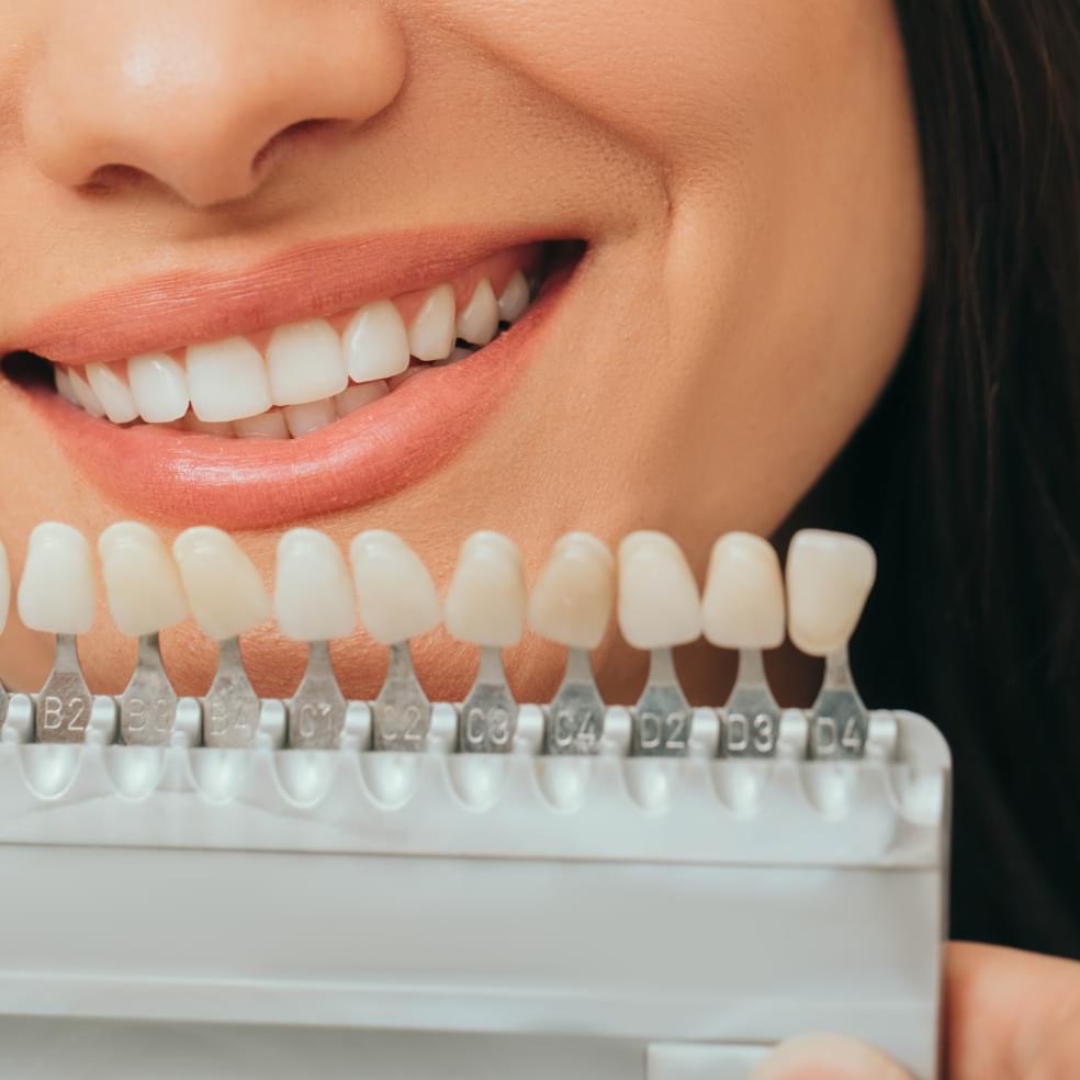 My Dental Hub patient smiling with newly placed porcelain veneers in Skokie, IL